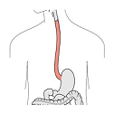 Corrosive oesophageal injuries: a preventable menace