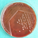 Antimicrobial susceptibility pattern of Acinetobacter isolates from ...