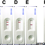 A 0.85% saline as alternative detection buffer for SD-Bioline HIV rapid ...