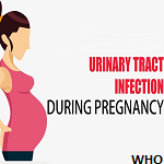 Urinary tract infections and associated factors in HIV infected ...